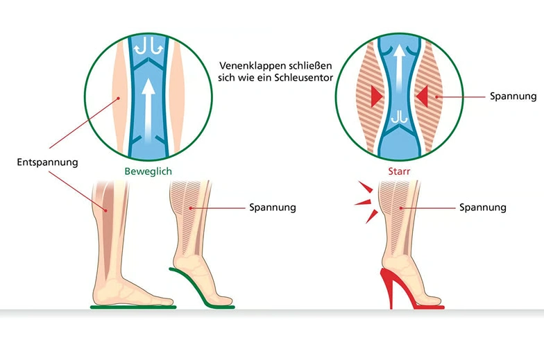 Diagramm zeigt den Einfluss von flachen und hohen Absätzen auf die Venenfunktion der Beine.